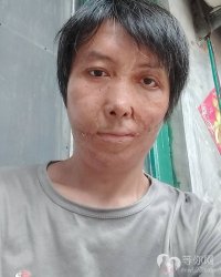 残疾帅哥征婚：梦缘，37岁 182cm 山东 德州 德城区